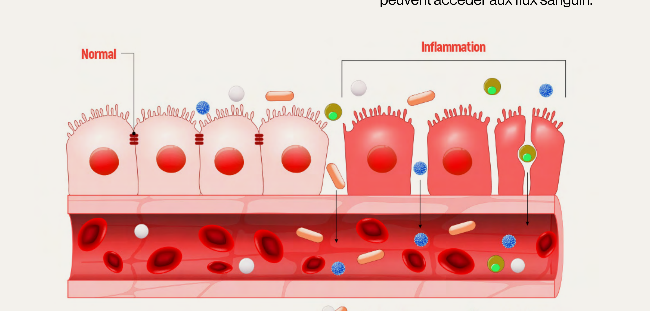 Schéma illustrant une paroi intestinale normale et une paroi inflammée